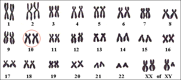 Het Crouzon-gen ligt op één of beide chromosomen nr 10.