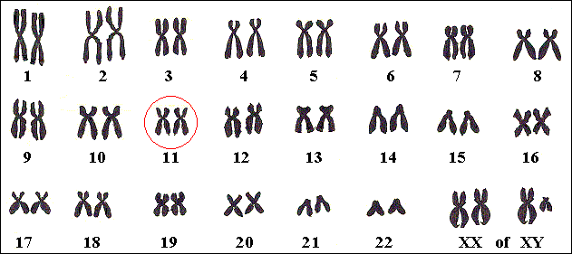 Het gen voor sikkelcelanemie ligt op chromosoom 11.