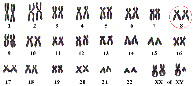 Het achtste chromosomenpaar is de plaats van het gen voor CHARGE.