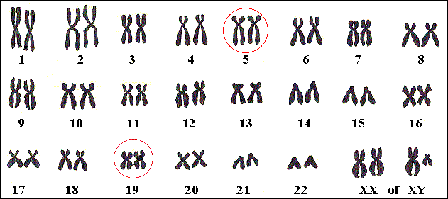 Genen voor Sotos liggen op chromosomen 5 en 19.