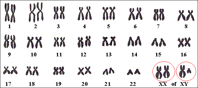 Het gen voor Lesch-Nyhan ligt op het X-chromosoom.