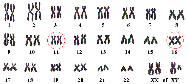 Chromosomen 11 en 16 hebben de genen voor Thalassemie.